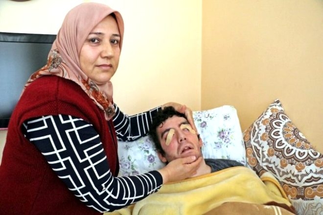 6 yıldır gözlerini kapatamıyor! galerisi resim 7