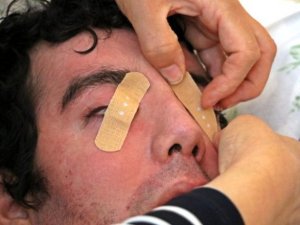 6 yıldır gözlerini kapatamıyor!