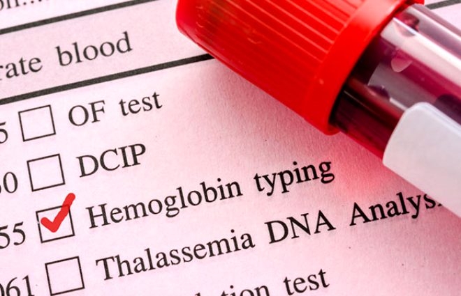 Bu hastalıkları olanlar dikkat! İşte koronavirüste en riskli 11 grup galerisi resim 10