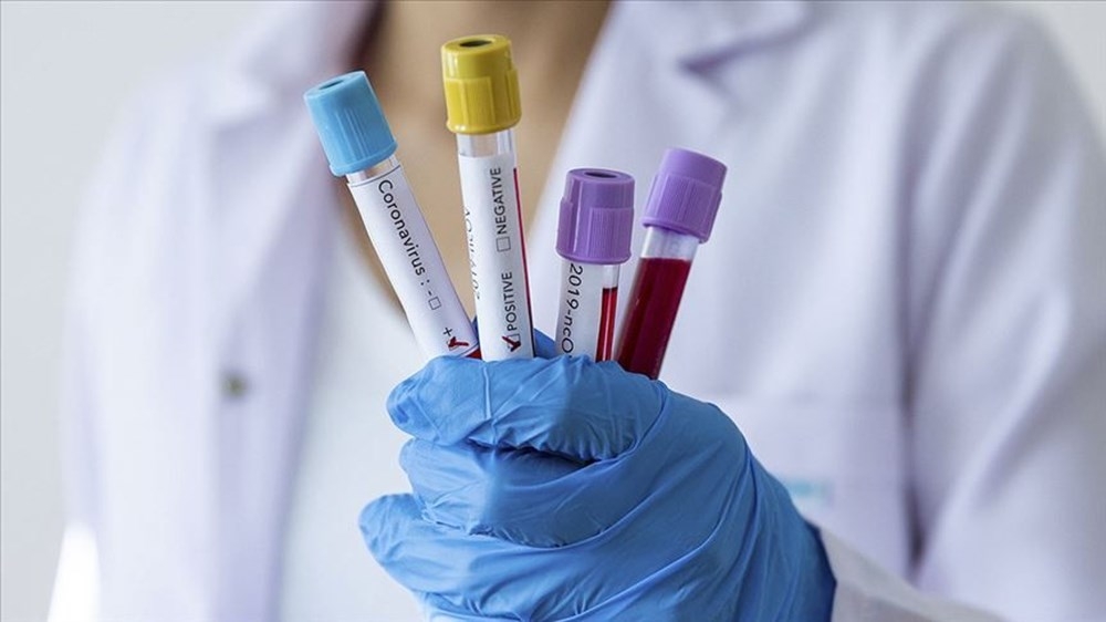 Corona virüs yarasaları neden öldürmüyor? İşte bilimin yanıtı galerisi resim 4