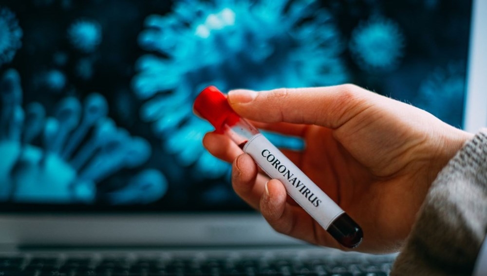 Corona virüs yarasaları neden öldürmüyor? İşte bilimin yanıtı galerisi resim 5