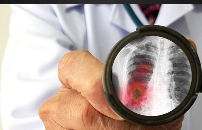 Koronavirüs kışın daha fazla mı artacak? galerisi resim 6