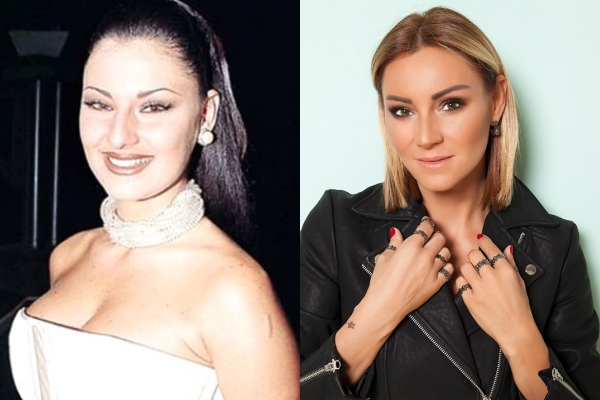 Estetikli Halleriyle Estetik Olmadan Önceki Halleri Arasında Uçurumlar O galerisi resim 10