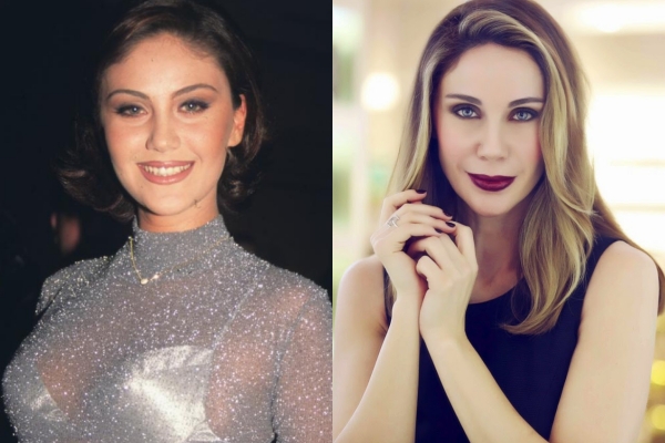 Estetikli Halleriyle Estetik Olmadan Önceki Halleri Arasında Uçurumlar O galerisi resim 12