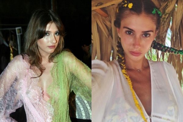 Estetikli Halleriyle Estetik Olmadan Önceki Halleri Arasında Uçurumlar O galerisi resim 13