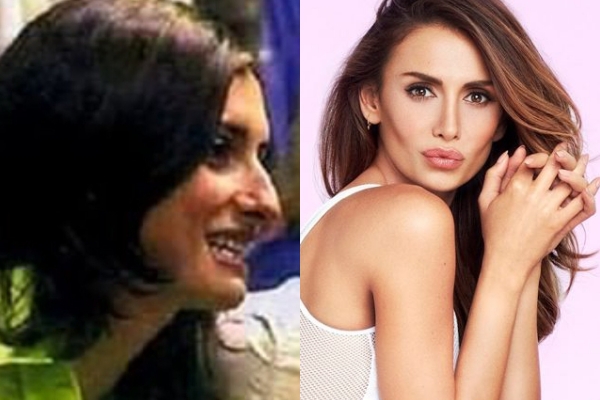 Estetikli Halleriyle Estetik Olmadan Önceki Halleri Arasında Uçurumlar O galerisi resim 14