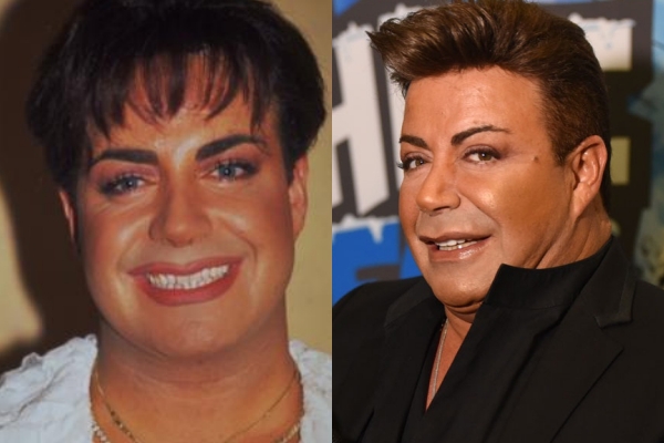 Estetikli Halleriyle Estetik Olmadan Önceki Halleri Arasında Uçurumlar O galerisi resim 2