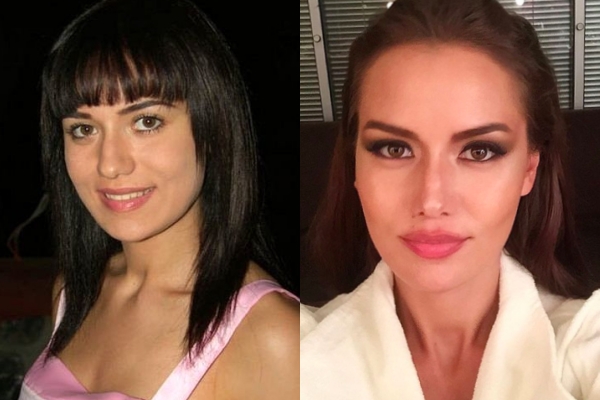 Estetikli Halleriyle Estetik Olmadan Önceki Halleri Arasında Uçurumlar O galerisi resim 5