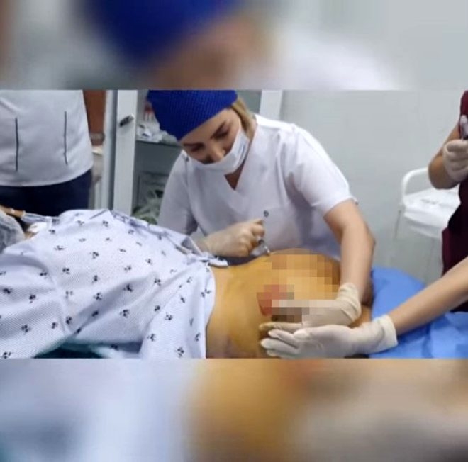 Kalça operasyonu olduğu anları sansürsüz paylaşan fenomen gelin adayı Na galerisi resim 4