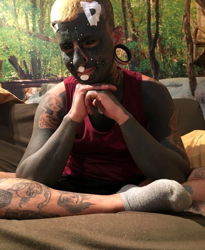 Adına yenilenme diyor! Dilini ikiye ayırdı, gözüne dövme yaptırdı, dudağ galerisi resim 7