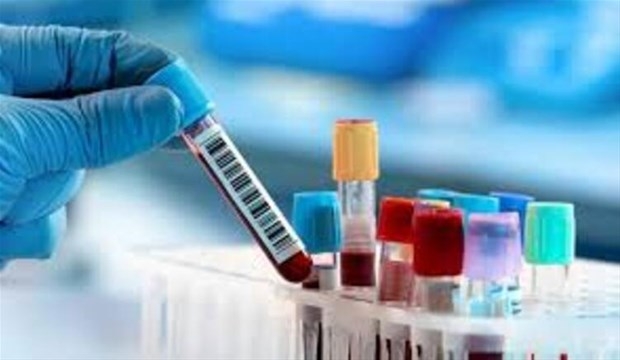 Corona virüs ilacı için flaş gelişme! Seri üretime geçiyorlar... galerisi resim 4