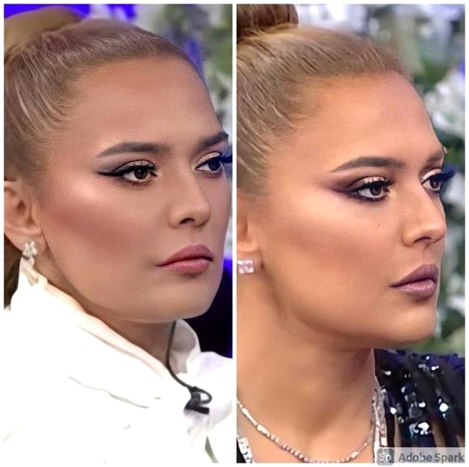 Güzelleşeyim derken sağlığından oldu! Estetik mağduru Akalın'ın boy galerisi resim 2