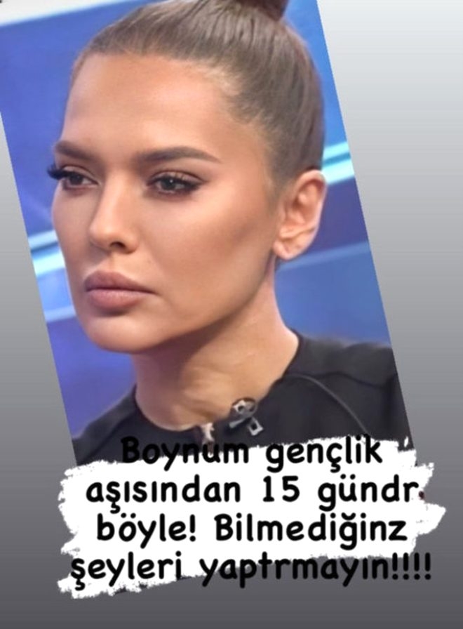 Güzelleşeyim derken sağlığından oldu! Estetik mağduru Akalın'ın boy galerisi resim 4