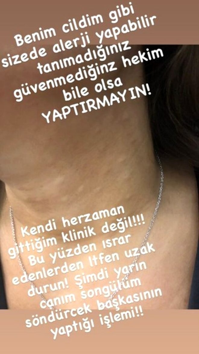 Güzelleşeyim derken sağlığından oldu! Estetik mağduru Akalın'ın boy galerisi resim 5
