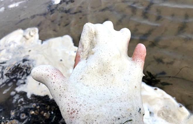 Bir anda köpürmeye başladı! Can çekişiyor! galerisi resim 5