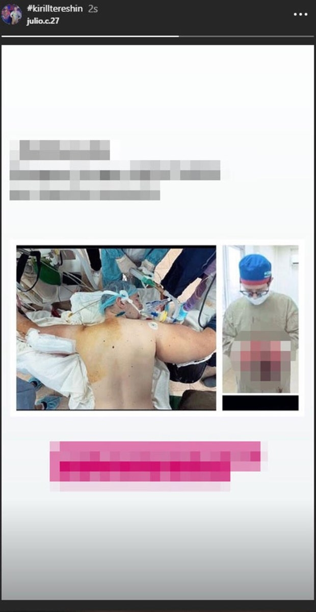 Biceps'e enjekte etti...Kolundan çıkan şoke etti! galerisi resim 8