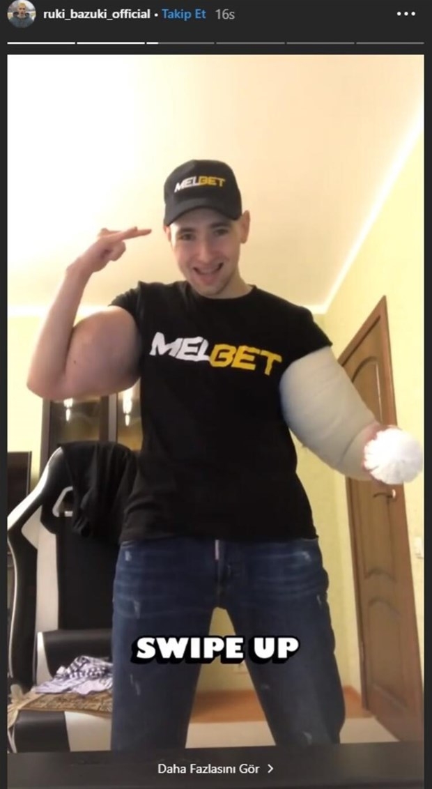 Biceps'e enjekte etti...Kolundan çıkan şoke etti! galerisi resim 9