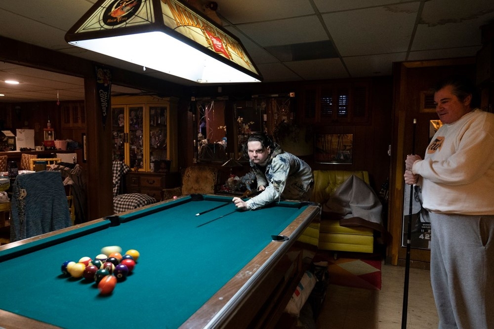 Dünyanın ilk başarılı eş zamanlı yüz ve çift el nakli operasyonu galerisi resim 2