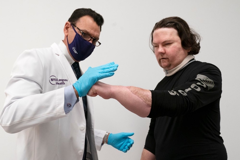 Dünyanın ilk başarılı eş zamanlı yüz ve çift el nakli operasyonu galerisi resim 9