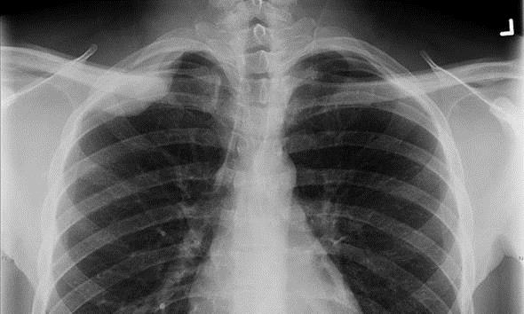 İnsanlık tarihini değiştiren icatlar galerisi resim 32