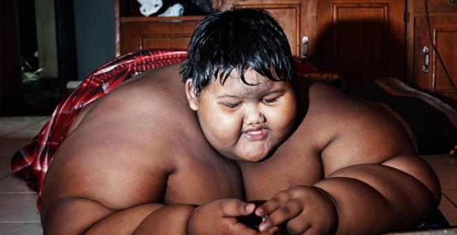 Dünyanın en şişman çocuğu 110 kilo verdi galerisi resim 1