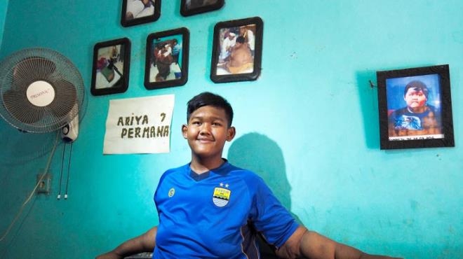 Dünyanın en şişman çocuğu 110 kilo verdi galerisi resim 10