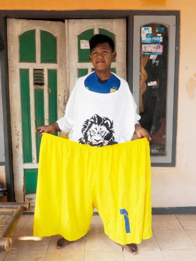 Dünyanın en şişman çocuğu 110 kilo verdi galerisi resim 11