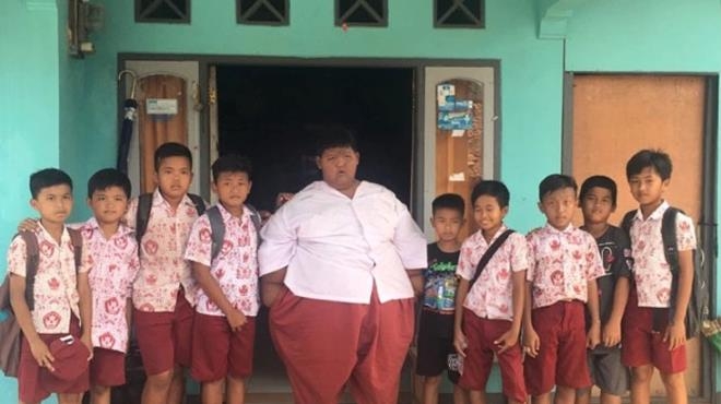 Dünyanın en şişman çocuğu 110 kilo verdi galerisi resim 2