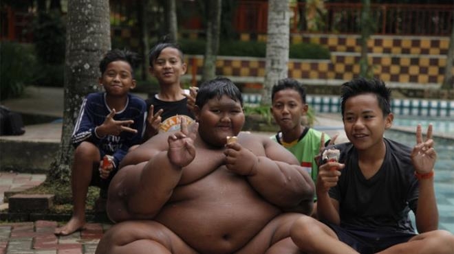 Dünyanın en şişman çocuğu 110 kilo verdi galerisi resim 3