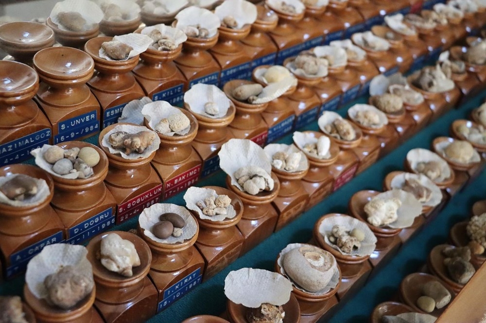 Doktorun ilginç 'taş' koleksiyonu: 2 bin ameliyattan çıkardı galerisi resim 11