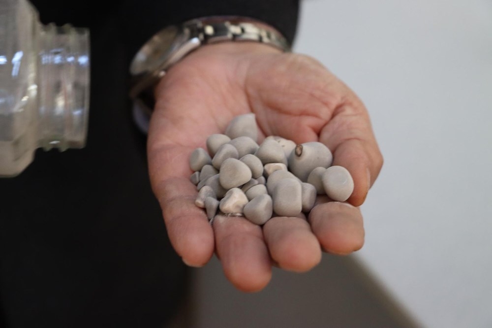 Doktorun ilginç 'taş' koleksiyonu: 2 bin ameliyattan çıkardı galerisi resim 3