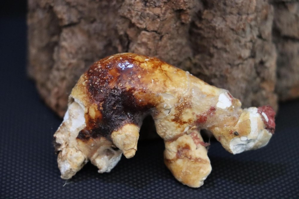 Doktorun ilginç 'taş' koleksiyonu: 2 bin ameliyattan çıkardı galerisi resim 4