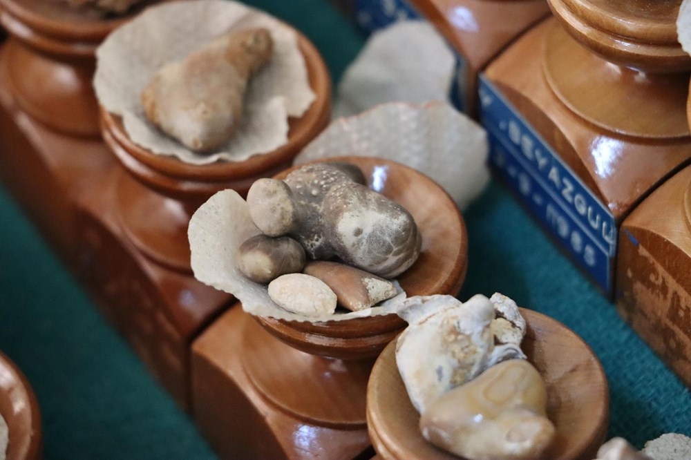 Doktorun ilginç 'taş' koleksiyonu: 2 bin ameliyattan çıkardı galerisi resim 5