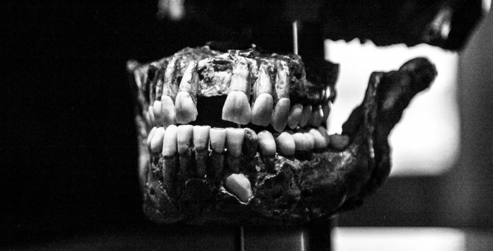 Dişler Yalnızca Ağızda Oluşmuyor! galerisi resim 1