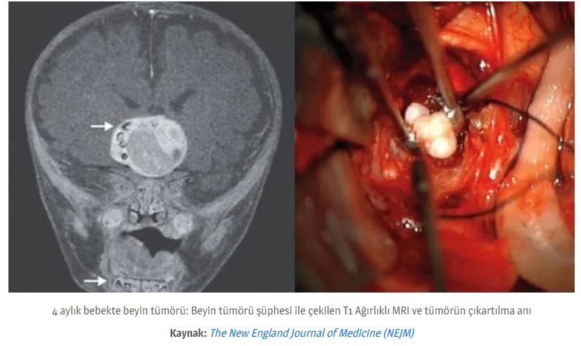 Dişler Yalnızca Ağızda Oluşmuyor! galerisi resim 2