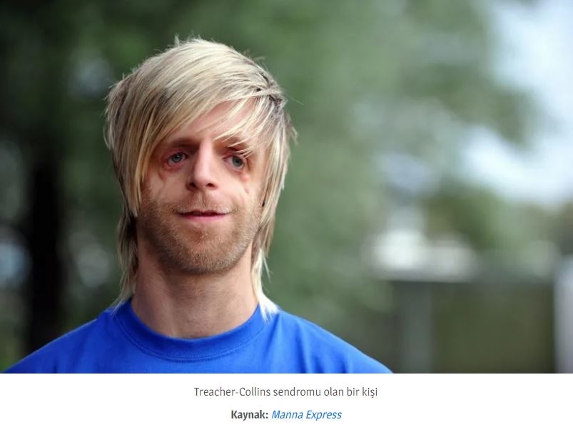 Dişler Yalnızca Ağızda Oluşmuyor! galerisi resim 3