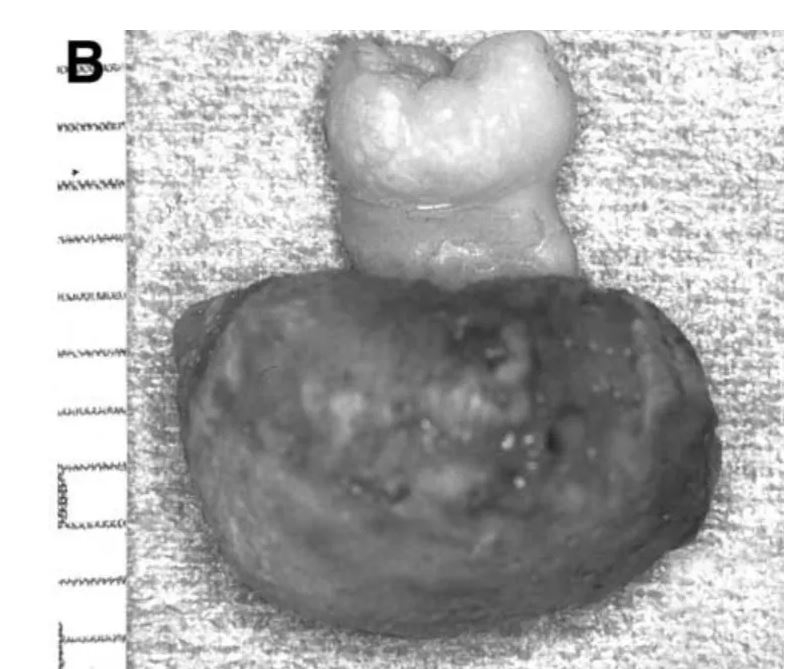Dişler Yalnızca Ağızda Oluşmuyor! galerisi resim 5