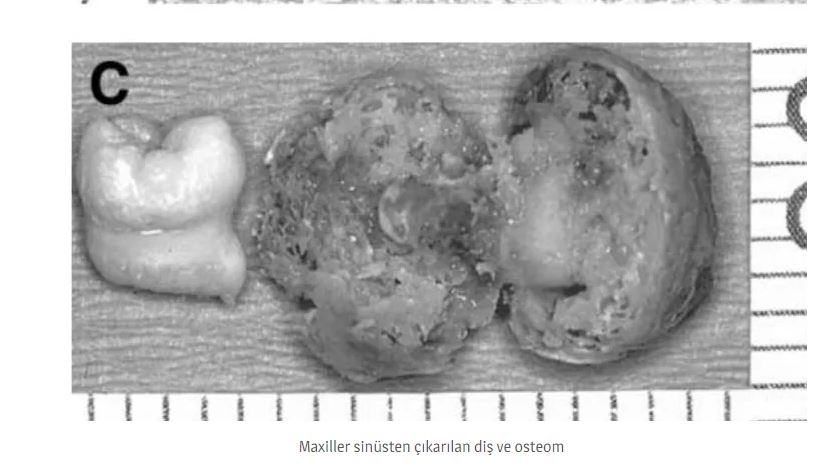 Dişler Yalnızca Ağızda Oluşmuyor! galerisi resim 6