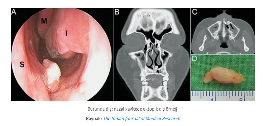 Dişler Yalnızca Ağızda Oluşmuyor! galerisi resim 8