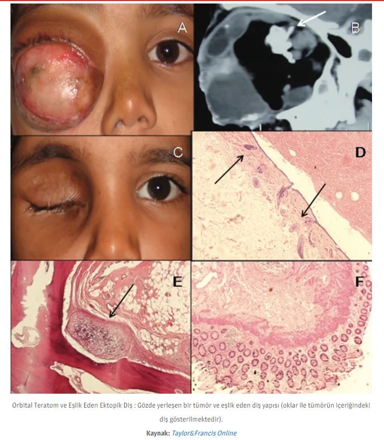 Dişler Yalnızca Ağızda Oluşmuyor! galerisi resim 9