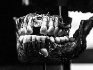 Dişler Yalnızca Ağızda Oluşmuyor!