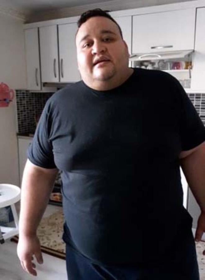 Zor nefes alıp veriyordu! 102 kilo veren gencin son hali inanılmaz galerisi resim 2