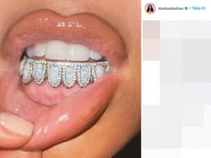 Kim Kardashian'ın 5 bin dolarlık diş mücevheri