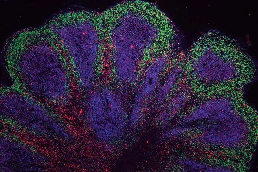 Cambridge Üniversitesi'nden demans ve felce karşı önemli adım: Labo galerisi resim 6