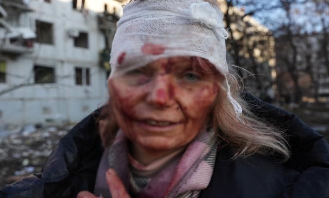 Savaşın Kurbanları Yine Siviller Oldu! Bilanço Gün Ağarınca Ortaya Çıktı galerisi resim 2