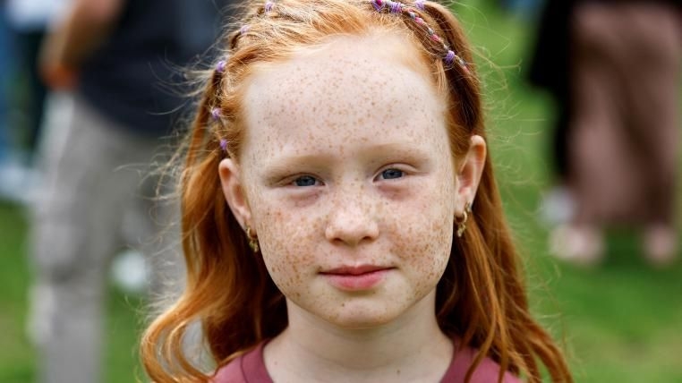 Kızıl Saç Günü için yüzlerce kişi Hollanda'da bir araya geldi galerisi resim 1