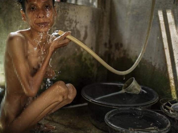 Endonezya'da insanlıktan utandıran görüntüler! galerisi resim 14