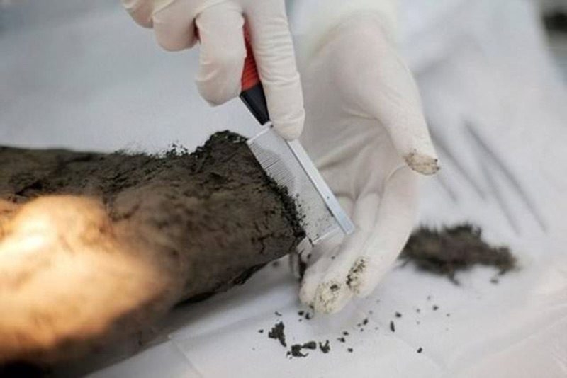 İnsanları dondurup sonra diriltmek mümkün mü? galerisi resim 2