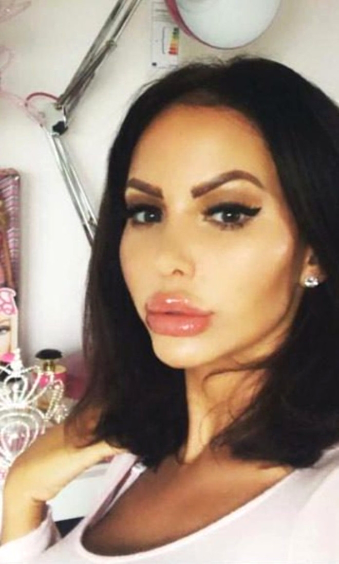 11 YILDA 28 KEZ ESTETİK AMELİYAT OLDU! DÖNÜŞÜMÜ İNANILMAZ galerisi resim 11