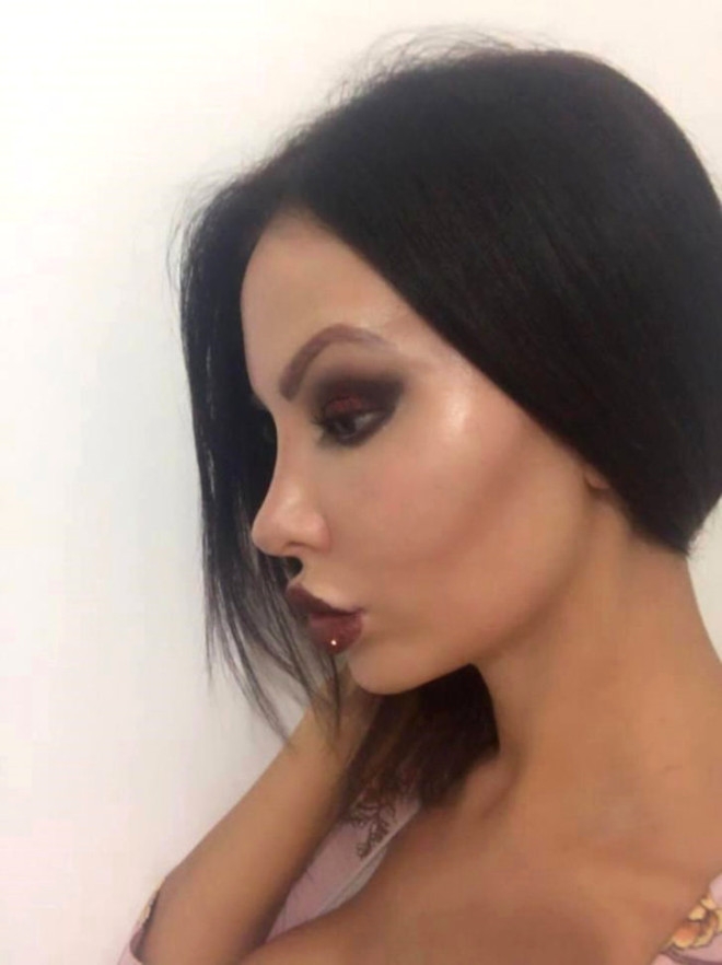 11 YILDA 28 KEZ ESTETİK AMELİYAT OLDU! DÖNÜŞÜMÜ İNANILMAZ galerisi resim 12